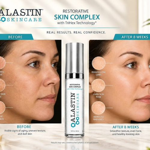 Alastin Skincare Restorative Skin Complex with TriHex Tech (1 fl oz / 29.6 ml )