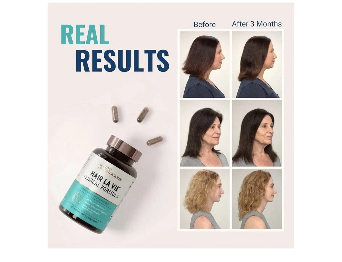 Hair La Vie Live Conscious Clinical Formula Hair Growth for Women & Men 90 Caps